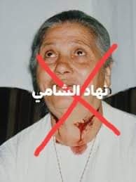 ظاهرة ال “ستيجماتا”تحت المجهر