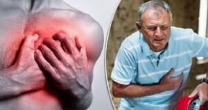 تصلب الشرايين