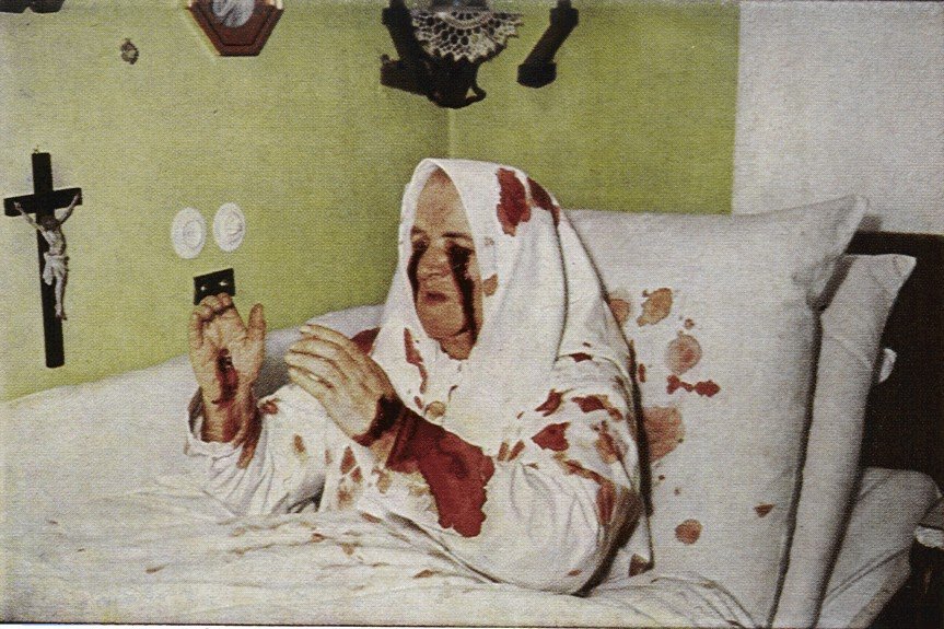 ظاهرة ال “ستيجماتا”تحت المجهر